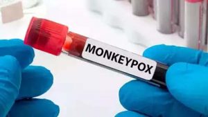 First Patient of Monkeypox in India Become Healthy