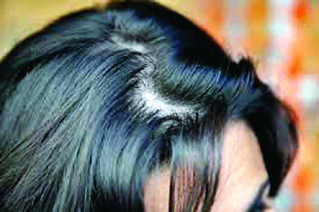 Hair Protection : ऐसे कर सकते हैं आप अपने बालों की सुरक्षा