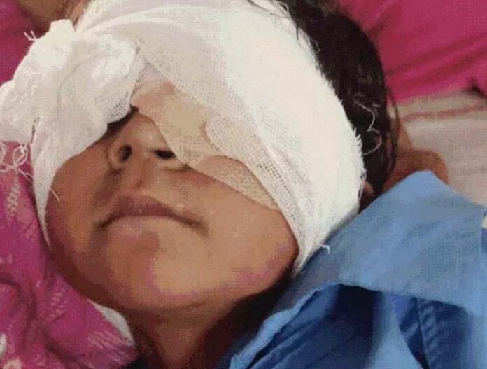 Teacher Damaged Student Eye