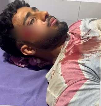 Kabaddi Player Attack : आखिर क्यों हुआ प्रदेश के इस कबड्‌डी प्लेयर पर हमला, लाठियों और गंडासे से किए गए वार